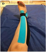 Middle East J Rehabil Health Stud